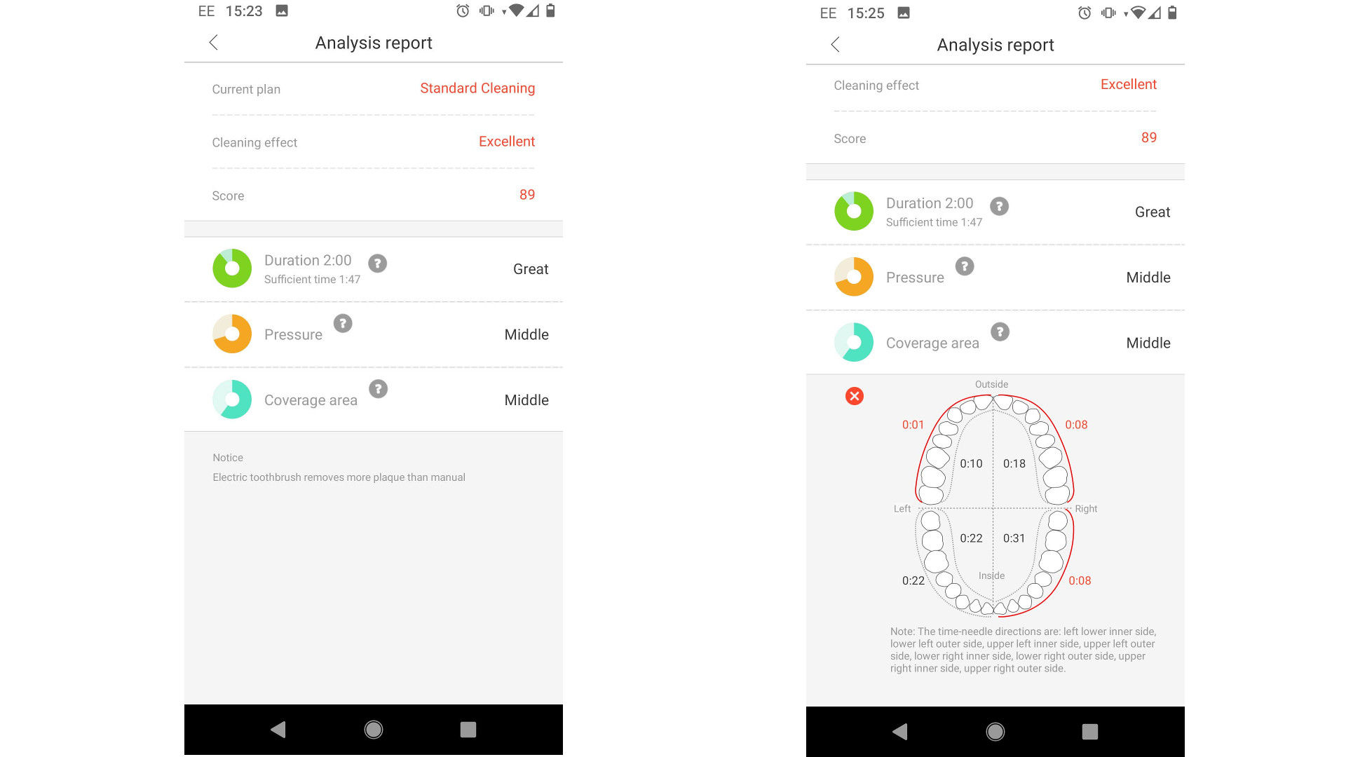 Brushing feedback in the Oclean app