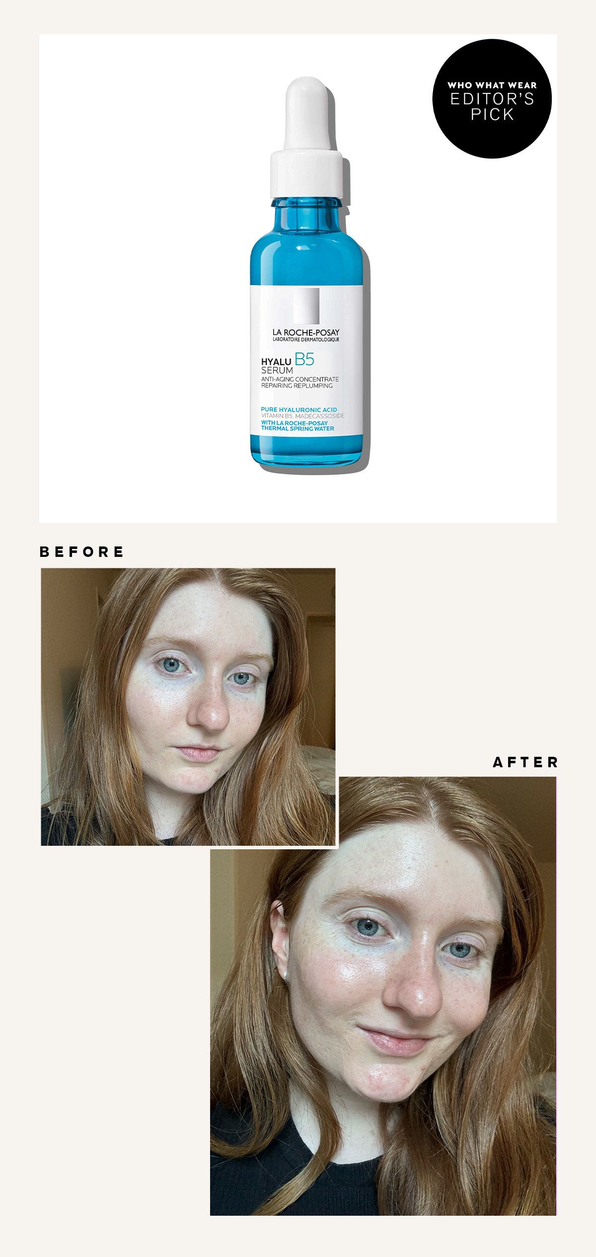 La Roche-Posay Hyaluronic Acid Serum: Before and After Picture