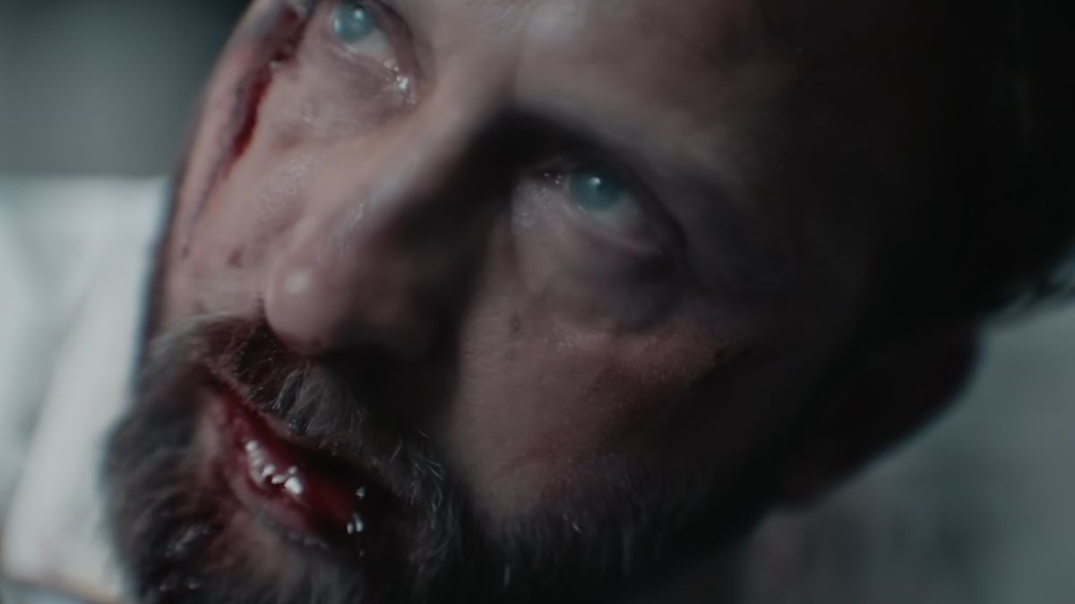 Close-up of a bloodied Wiktor Forst in Detective Forst episode 3.