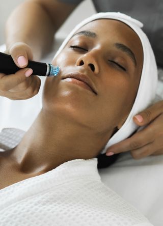 Microdermabrasion