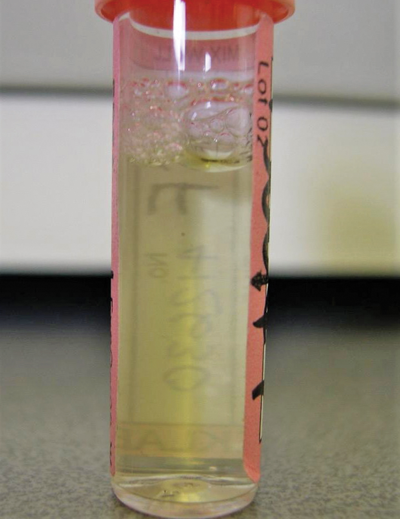 HAH301.vet_.p_ivens_xanthochromic_csf_fluid_free_wording.jpg