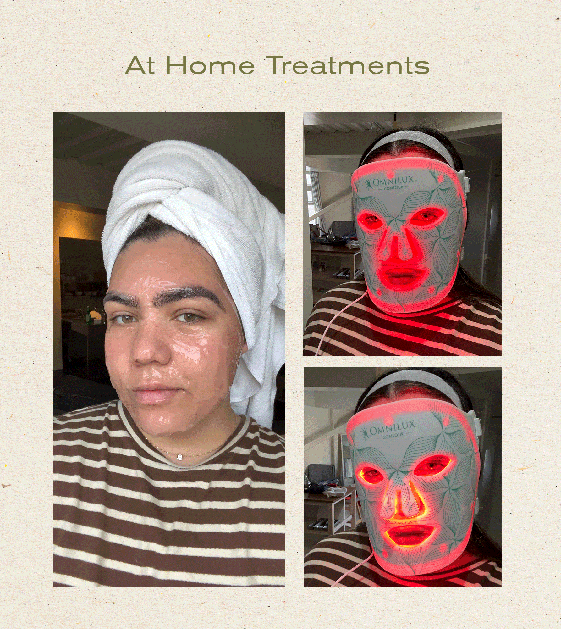 Photos of editor Ana Escalante and her skincare routine and progress photos throughout her engagement skincare process.