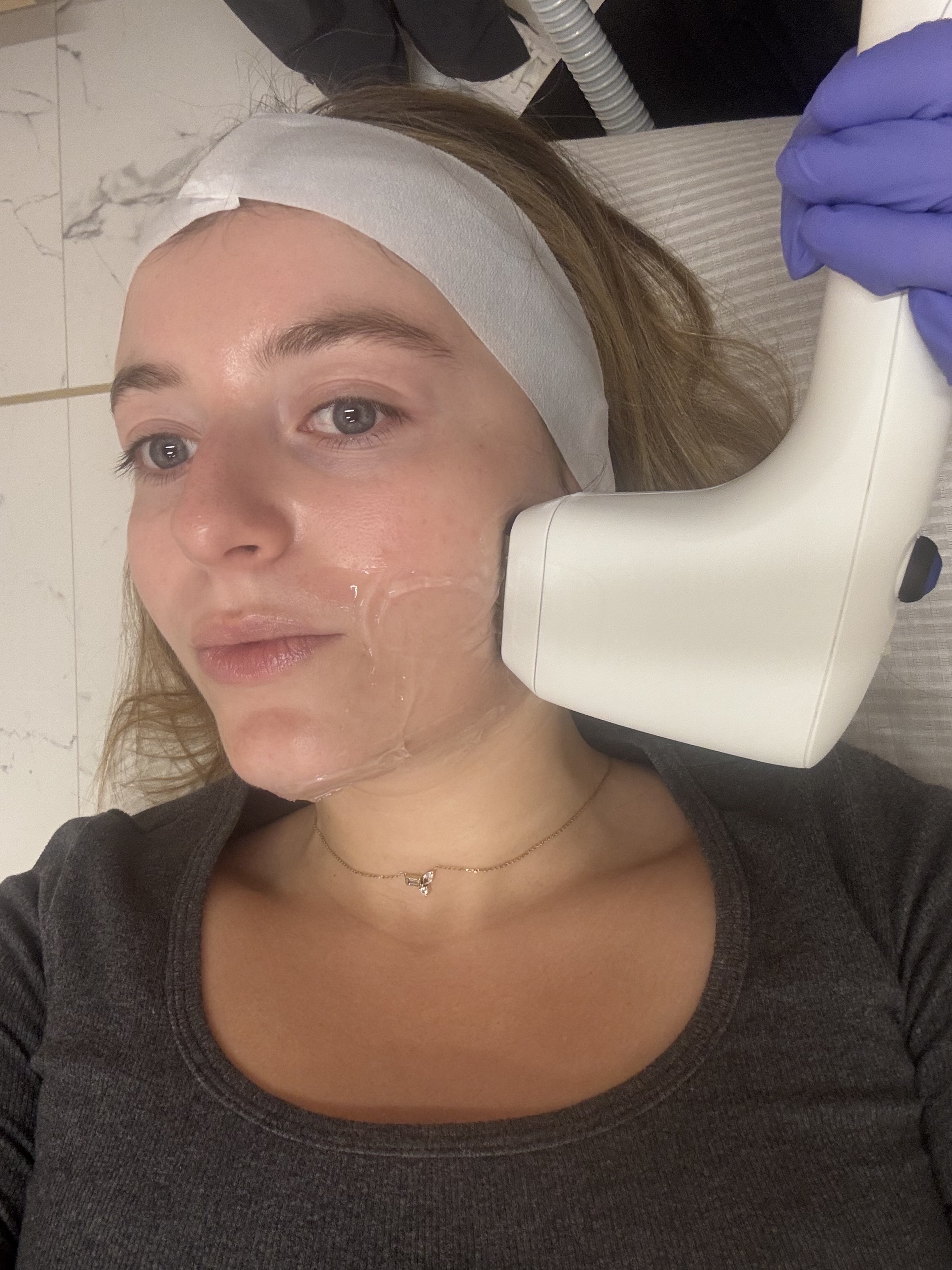 Samantha holender receiving the sofwave treatment