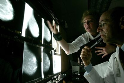 Doctors look at breast x-rays.