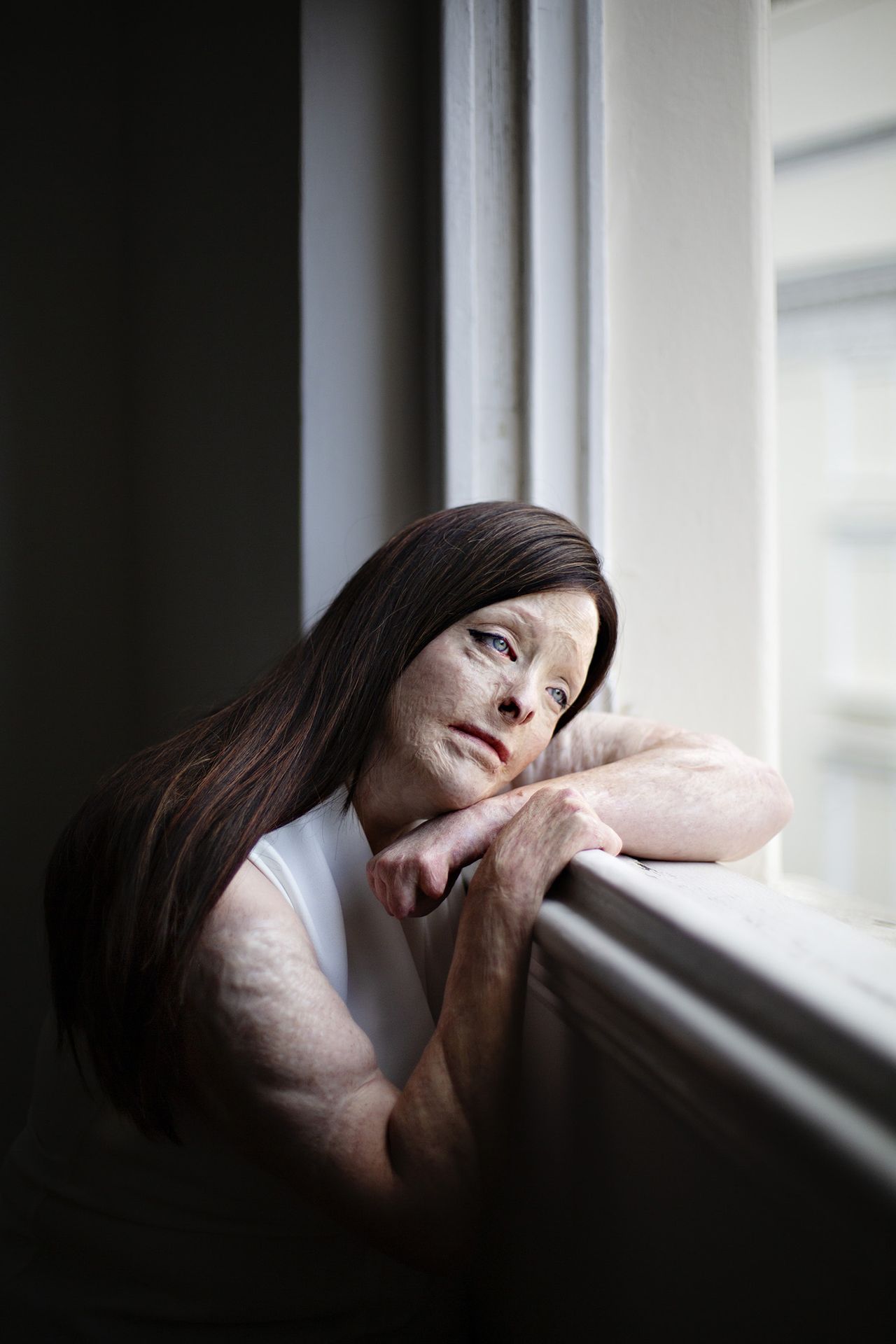 A woman with fire scars and long hair leans pensively against a window, resting their arms on the ledge in a softly lit room