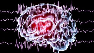 A computer illustration of brain waves in epilepsy.