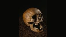The bog skull, known as Porsmose Man, dates from the Neolithic of Denmark. He met a violent death, according to bone arrowheads found embedded in his skull and sternum.