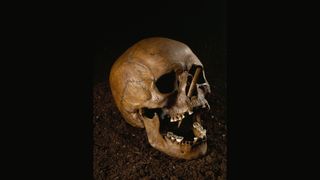 The bog skull, known as Porsmose Man, dates from the Neolithic of Denmark. He met a violent death, according to bone arrowheads found embedded in his skull and sternum.