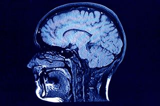 A close up of a brain scan