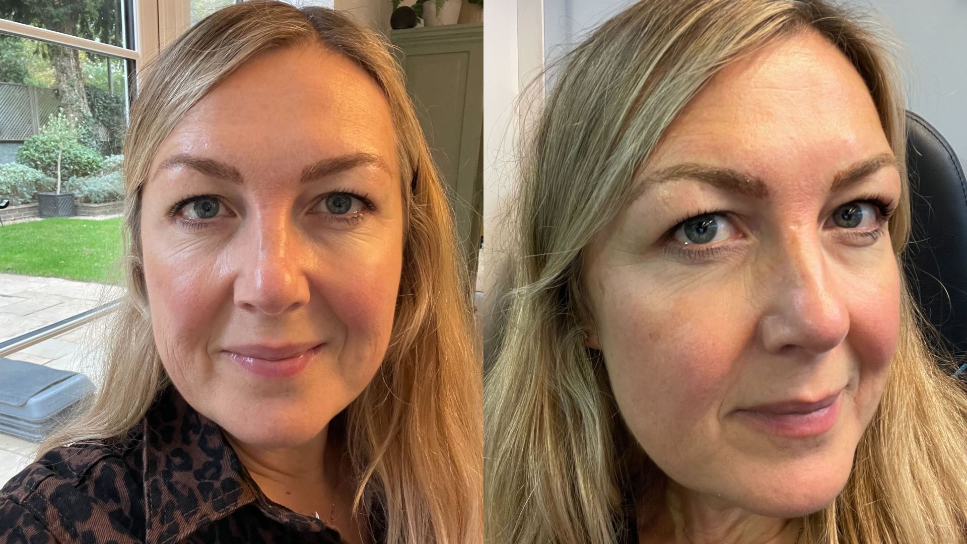 Sarah cooper white pictured after microblading treatment