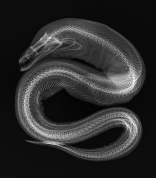 Moray X-ray