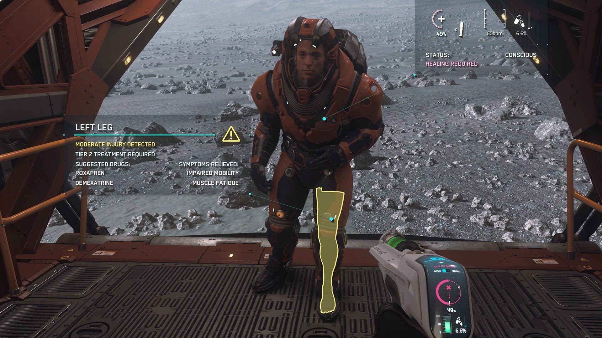Body damage shown in Star Citizen as a player in front of your character shows an injured leg.