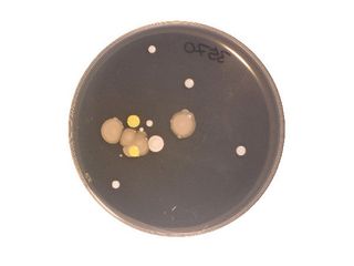 These microbes came from someone's bellybutton. In addition to stirring up microbes already present when we walk into a room, we also shed some microbes from our skin. 