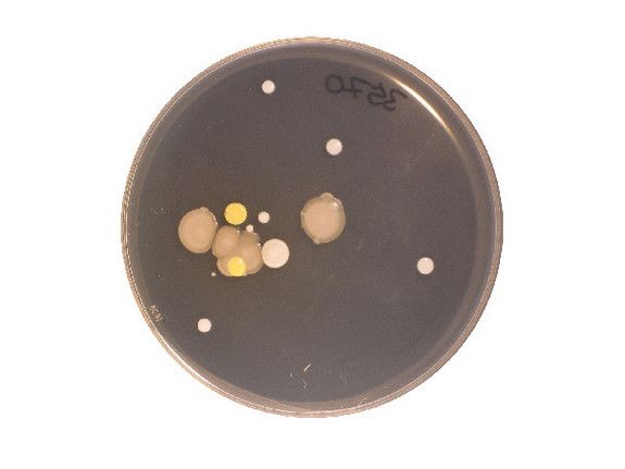 These microbes came from someone&#039;s bellybutton. In addition to stirring up microbes already present when we walk into a room, we also shed some microbes from our skin. 