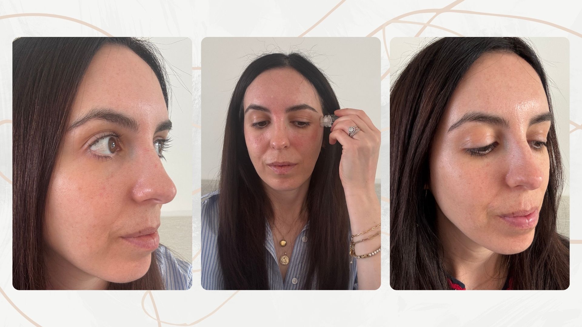beauty editor tries vita vitae microneedling home infusion kit