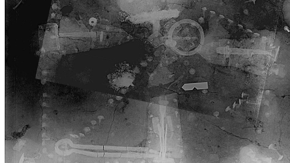 An X-ray image shows assorted artifacts.