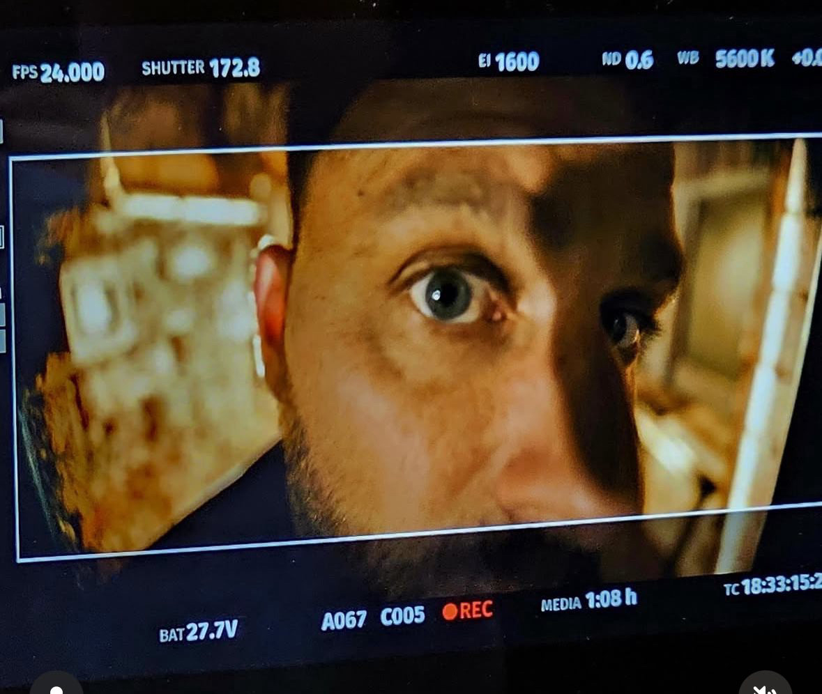 Image from a video monitor showing a close up of a person's eye