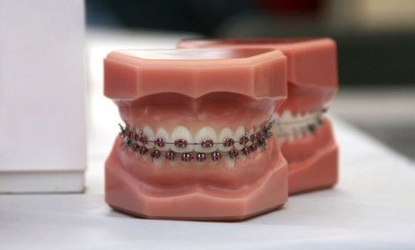 Devin Bost is suing his orthodontist for putting him in braces for 11 years; according to the president of the American Association of Orthodontists, braces should only be worn for up to thre