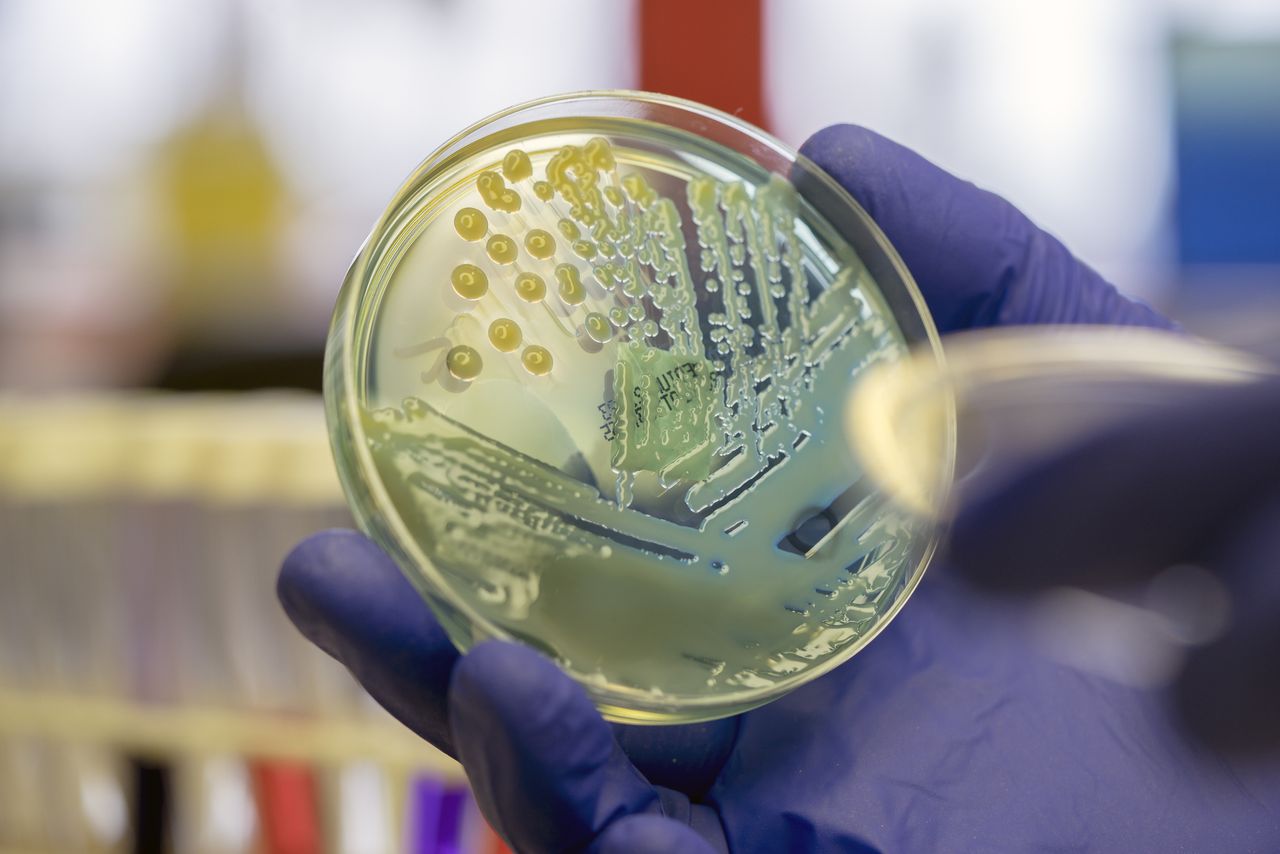 Bacteria on agar petri dish held by gloved hands. 