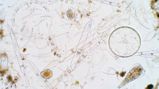 A microscope image showing a variety of organisms in water