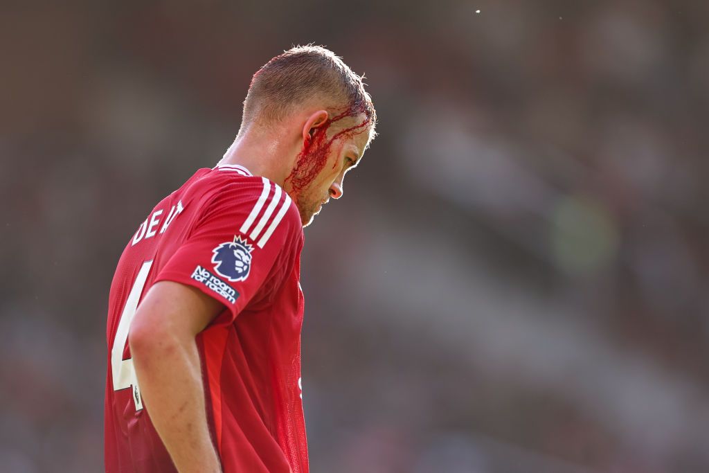 Matthijs de Ligt of Manchester United with a blooded head during the Premier League match between Manchester United FC and Brentford FC at Old Trafford on October 19, 2024 in Manchester, England.