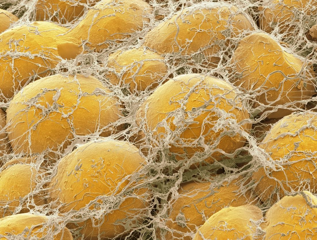 This colored scanning electron micrograph (SEM) shows fat cells surrounded by fine strands of supportive connective tissue.