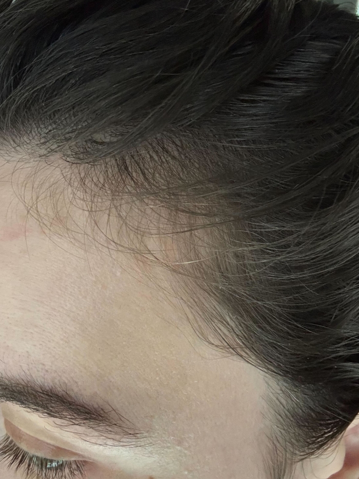 Deputy beauty editor Grace Lindsay before testing the Kérastase Genesis Anti-Hair Fall Nourishing and Fortifying Hair Serum