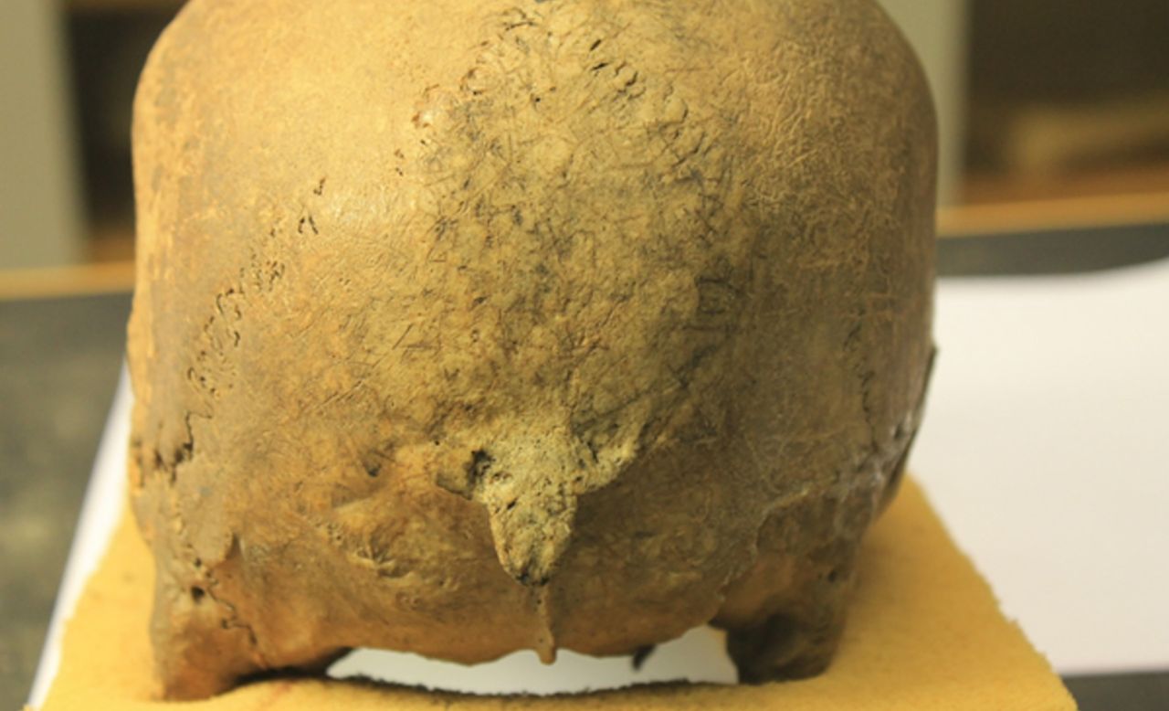 The back of a skull with damage