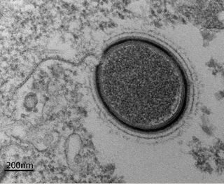 The new virus, called <em>Mollivirus sibericum</em>, was found in Siberian permafrost.