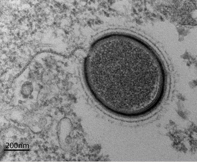 The new virus, called &lt;em&gt;Mollivirus sibericum&lt;/em&gt;, was found in Siberian permafrost.