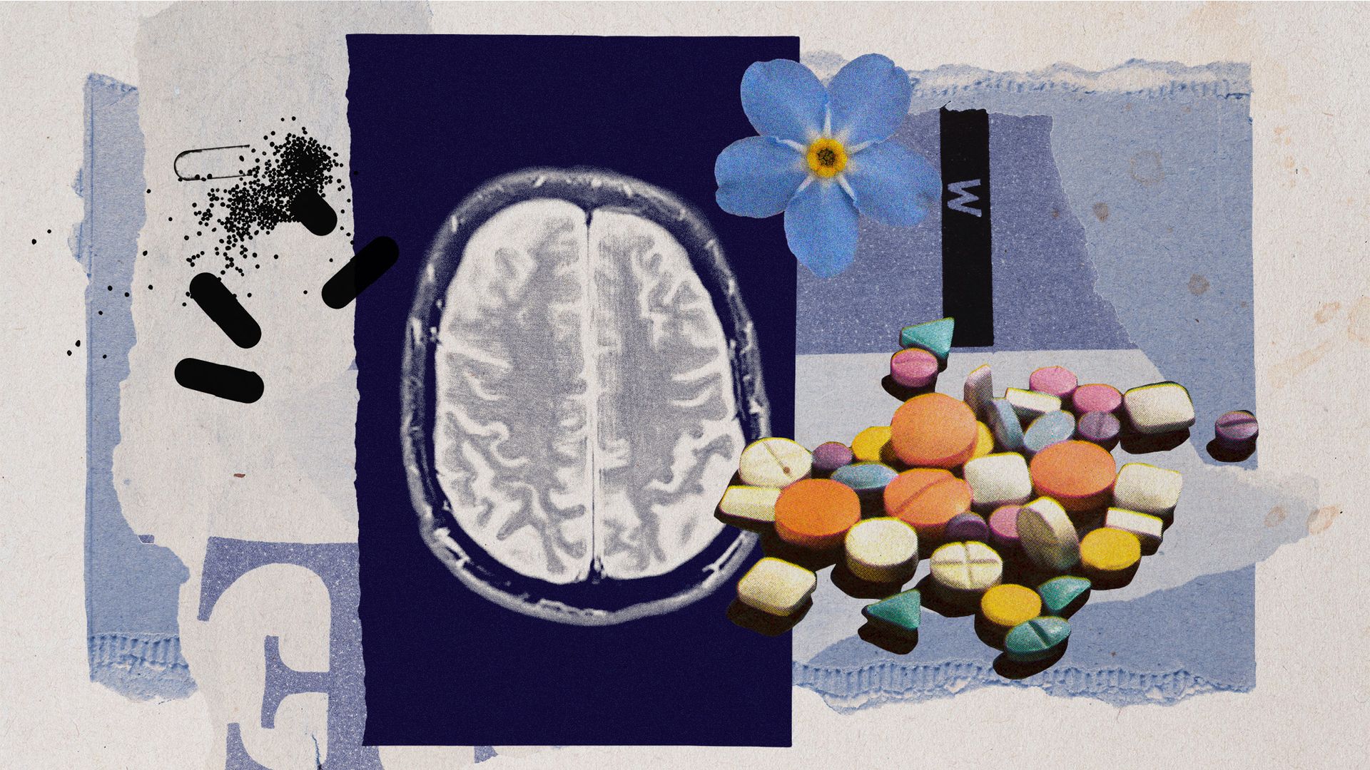  Alzheimer’s disease no longer considered untreatable 