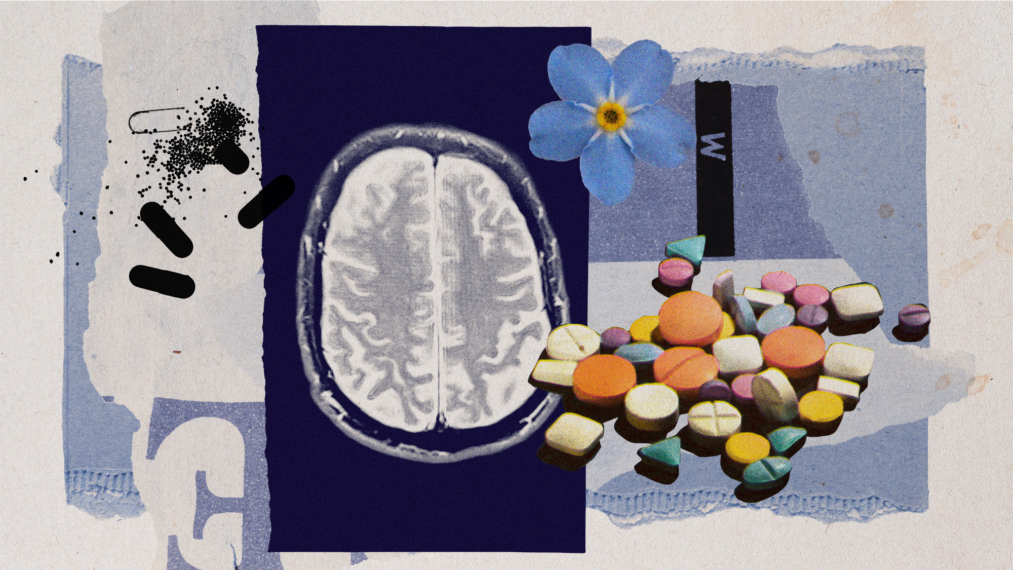 Photo collage of a brain MRI, pills, and a forget-me-not