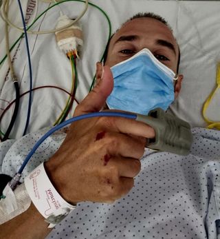 Alejandro Valverde in hospital after hit-and-run incident