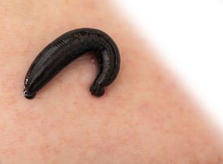 A leech, on a person's skin