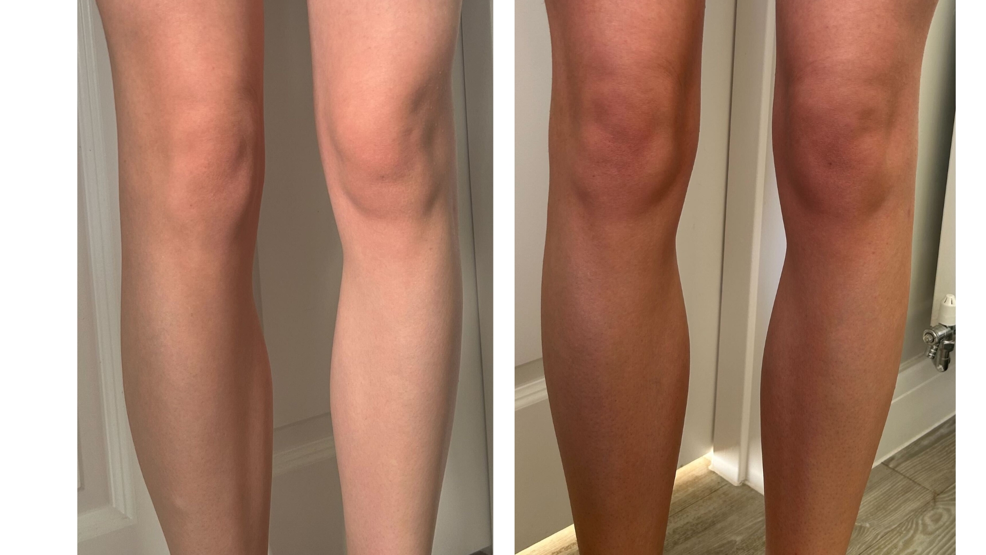 Legs before using the Vita Liberata The Glaze (L) and legs after using Vita Liberata The Glaze (R)