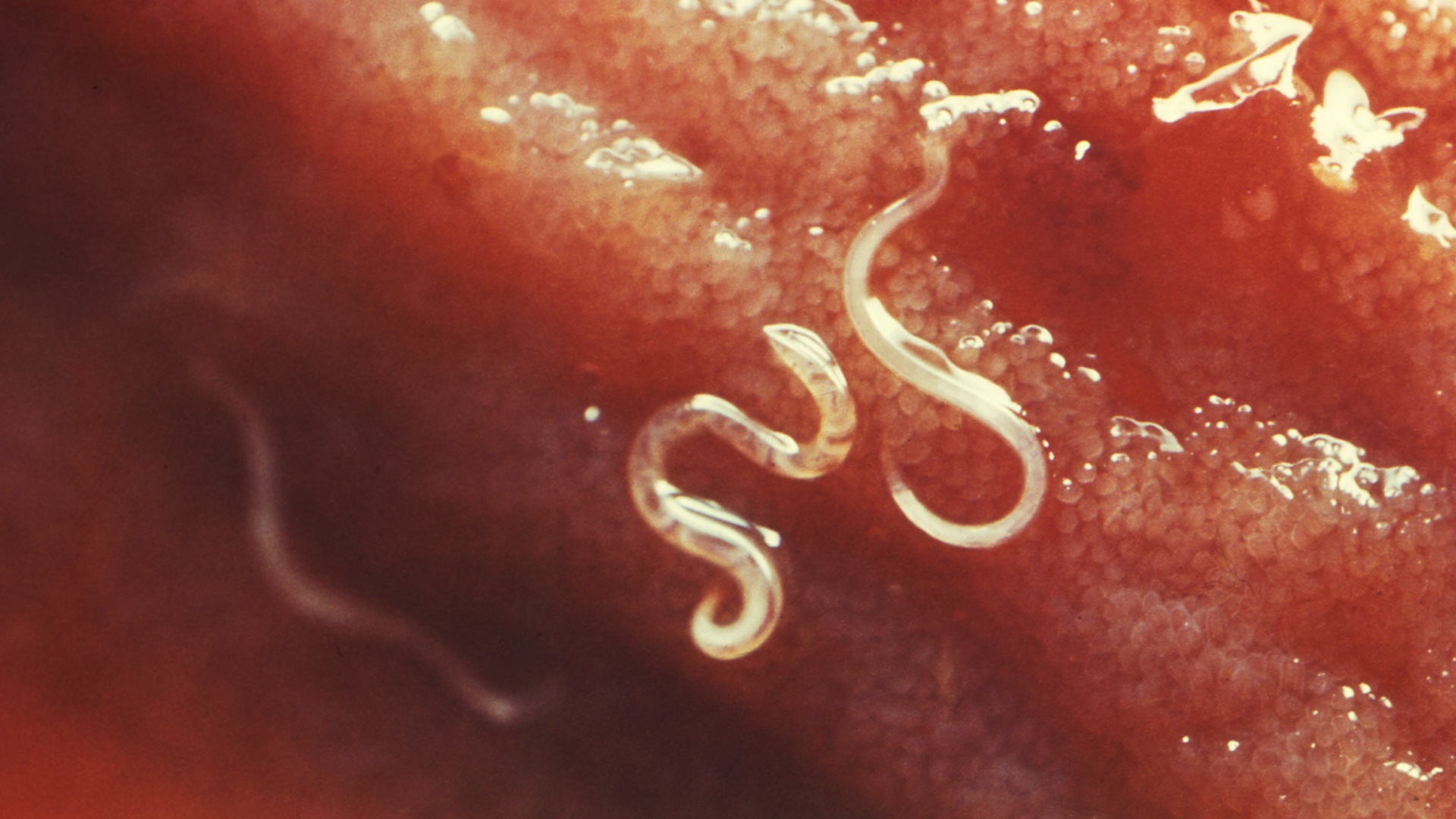 This photograph depicts a close view of the small intestinal mucosa of a canine, revealing the presence of Ancylostoma caninum hookworms, atop the intestinal villi.