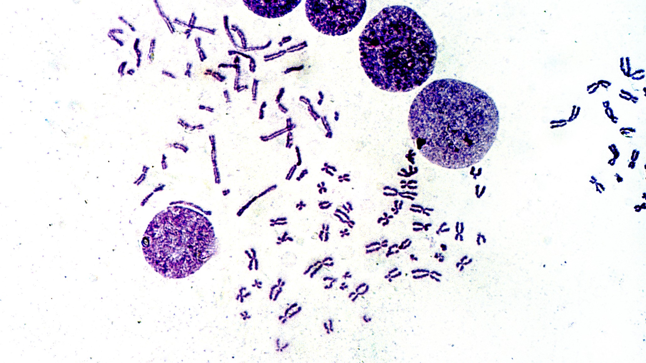 Chromosomes can be visible through a strong microscope when a stain is applied. The term chromosome comes from the Greek words for color (chroma) and body (soma) due to their ability to be strongly stained by dyes used in research.