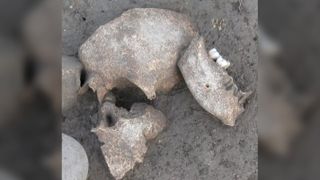 Human remains found at the Celtic site of Le Cailar in southern France.