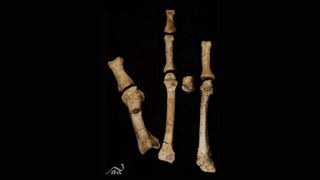 Eight fossil bones found in Ethiopia make up the "Burtele foot".