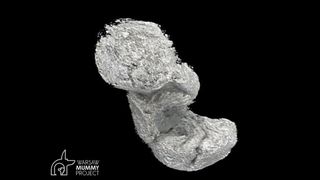 A computer generated image of the object, potential a fetus, found inside the first known pregnant mummy. .