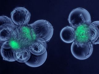This micrograph shows cells called myoblasts attached to spherical microcarriers, which allow the growth of adult stem cells that have been isolated from skeletal muscle. The stem cells are shown in green. By combining these cells in a bioreactor, the mus