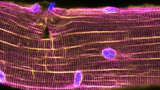 Microscopic image shows muscle cell nuclei converging on a tear in a muscle fiber