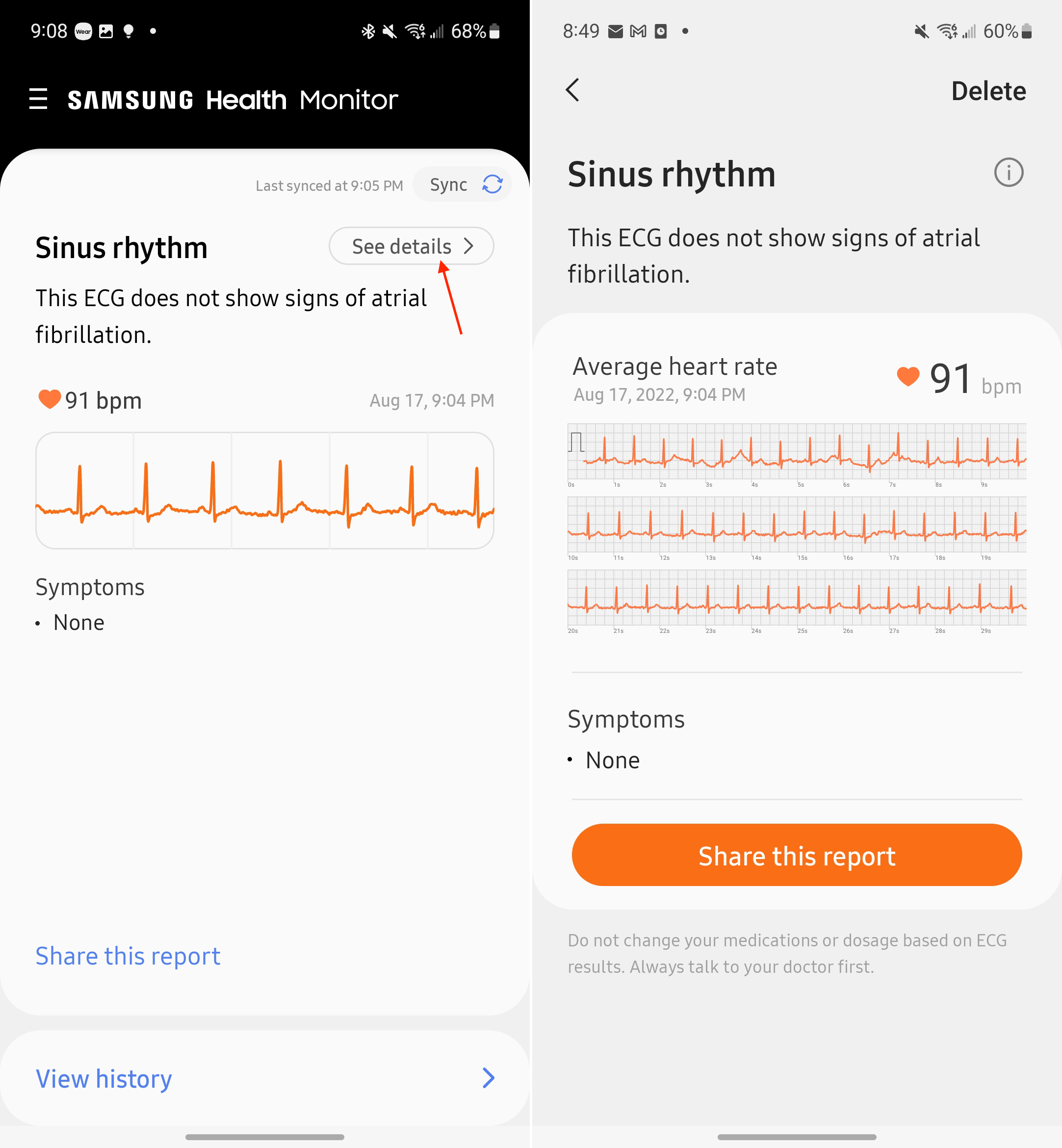 View ECG results in the Samsung Health Monitor app