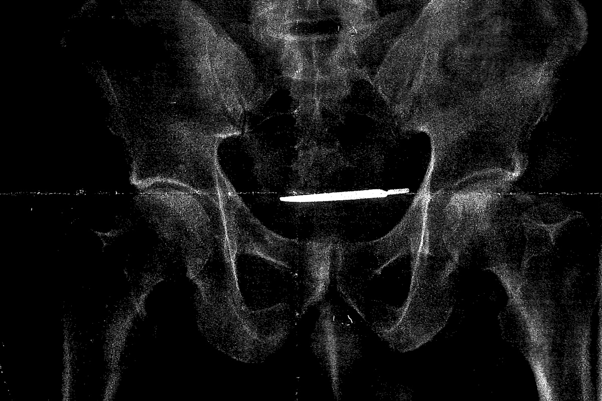 scalpel, faxon law group