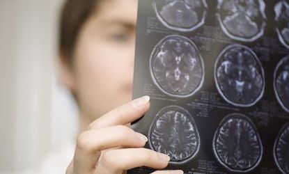 A CT scan of a patient's brain: People are not consciously aware of the vast majority of their brains' ongoing activities, says David Eagleman.