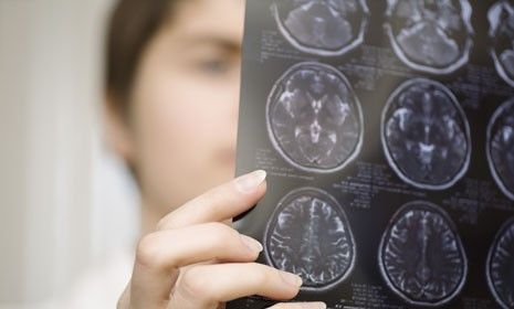 A CT scan of a patient&amp;#039;s brain: People are not consciously aware of the vast majority of their brains&amp;#039; ongoing activities, says David Eagleman.