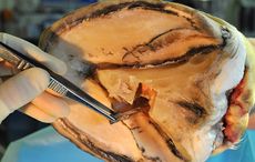 vet foreign body removal 05 10 2017 issue Wood FB fragment removed from foot at surgery 2