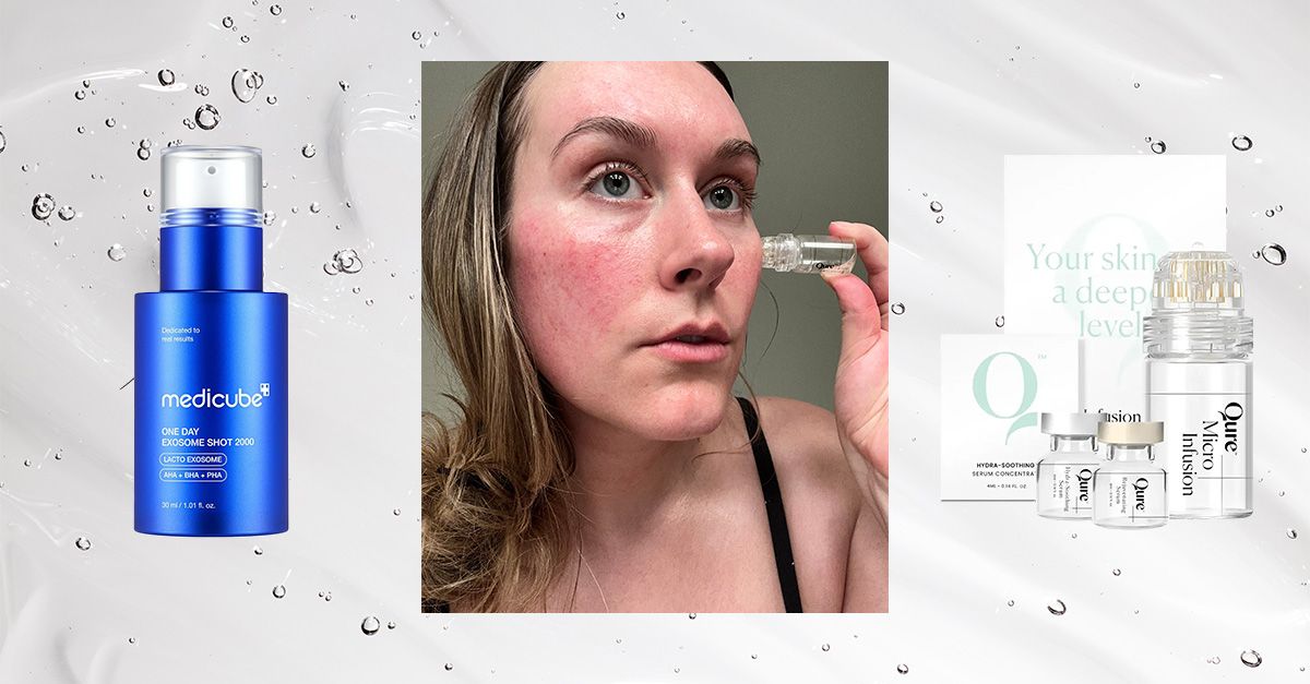 Most Derms Don't Recommend DIY Microneedling—2 Effective Alternatives