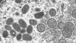This electron microscope image shows virus particles of the monkeypox virus taken from human skin in 2003.