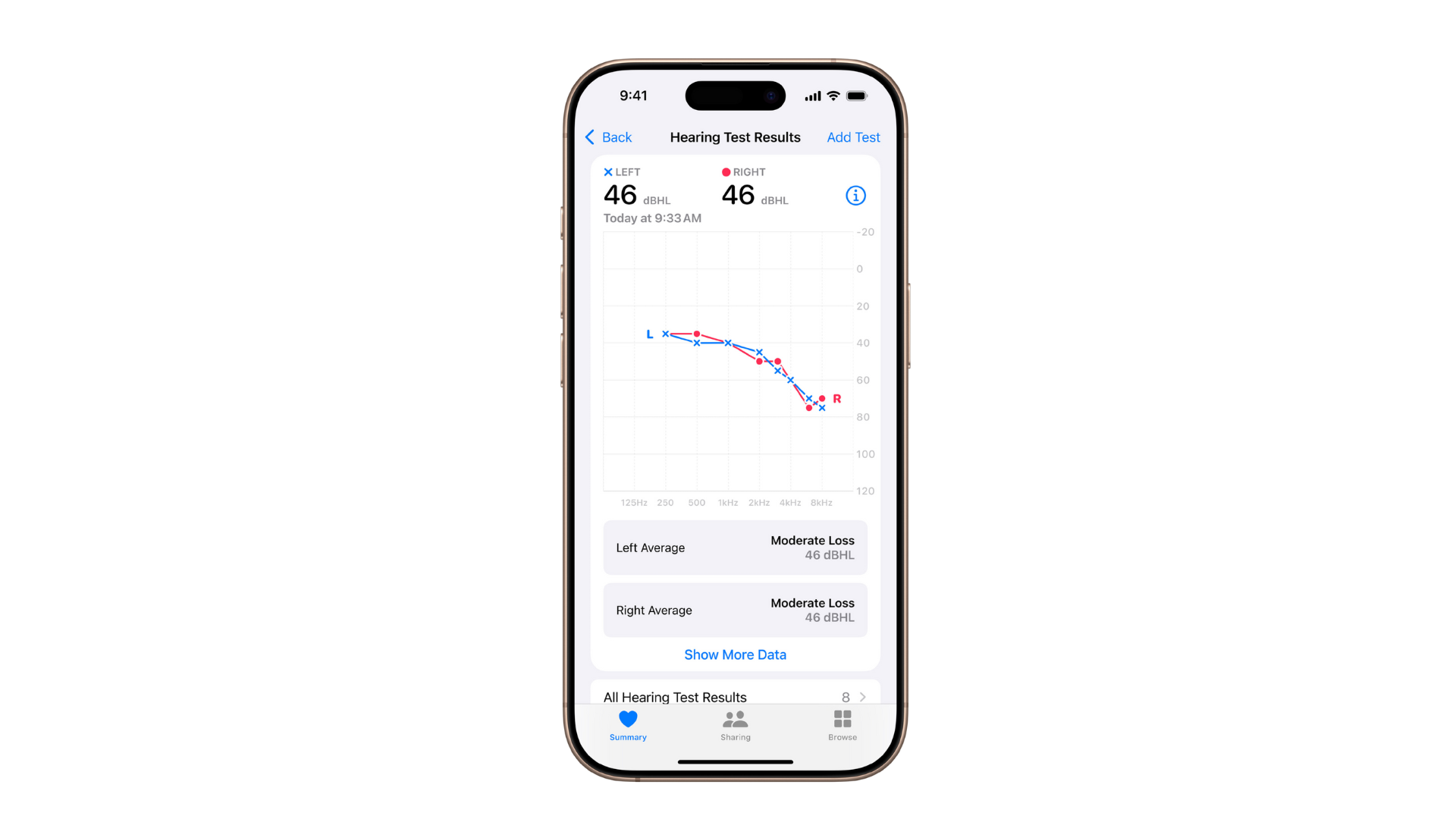 an image of an iphone open on the apple health app. It is showing the results of a hearing test done through airpods and the health app